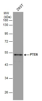 PTEN antibody detects PTEN protein by western blot analysis. Various whole cell extracts (30 ug) were separated by 10% SDS-PAGE,and the membrane was blotted with PTEN antibody (GTX101025) diluted at a dilution of 1:500.