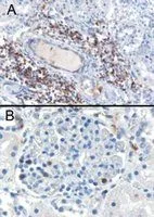 IHC-P analysis of human Kidnay using GTX10103 SH3BP1 antibody,C-term. Antigen retrieval : citrate buffer pH 6 Dilution : 0.3ug/ml A) in the interstitial parenchyma of the kidney. B) in a glomerulus of the kidney