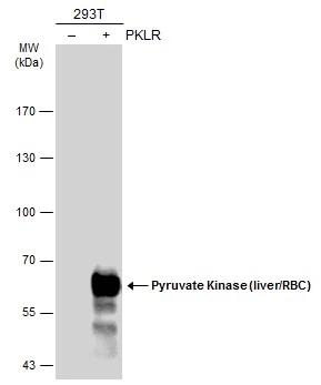 Non-transfected (�) and transfected (+) 293T whole cell extracts (30 ug) were separated by 7.5% SDS-PAGE,and the membrane was blotted with Pyruvate Kinase (liver/RBC) antibody (GTX101033) diluted at 1:1000.