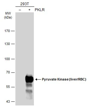 Non-transfected (–) and transfected (+) 293T whole cell extracts (30 μg) were separated by 7.5% SDS-PAGE, and the membrane was blotted with Pyruvate Kinase (liver/RBC) antibody (GTX101033) diluted at 1:1000. The HRP-conjugated anti-rabbit IgG antibody (GTX213110-01) was used to detect the primary antibody. Non-transfected (–) and transfected (+) 293T whole cell extracts (30 μg) were separated by 7.5% SDS-PAGE, and the membrane was blotted with Pyruvate Kinase (liver/RBC) antibody (GTX101033) diluted at 1:1000. The HRP-conjugated anti-rabbit IgG antibody (GTX213110-01) was used to detect the primary antibody.