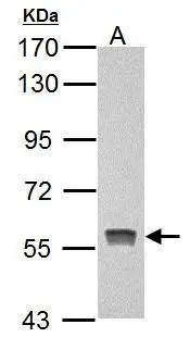 Pyruvate Kinase (liver/RBC) antibody detects Pyruvate Kinase (liver/RBC) protein by Western blot analysis. A. 20 ug Rat liver lysate/extract 7.5% SDS-PAGE Pyruvate Kinase (liver/RBC) antibody (GTX101033) dilution: 1:10000 Pyruvate Kinase (liver/RBC) antibody detects Pyruvate Kinase (liver/RBC) protein by Western blot analysis. A. 20 ug Rat liver lysate/extract 7.5% SDS-PAGE Pyruvate Kinase (liver/RBC) antibody (GTX101033) dilution: 1:10000