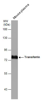 Mouse tissue extract (50 μg) was separated by 7.5% SDS-PAGE, and the membrane was blotted with Transferrin antibody [N3C3] (GTX101035) diluted at 1:1000. The HRP-conjugated anti-rabbit IgG antibody (GTX213110-01) was used to detect the primary antibody.