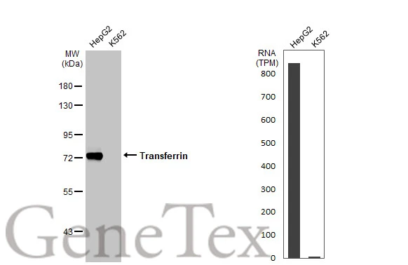 Various whole cell extracts (30 μg) were separated by 7.5% SDS-PAGE, and the membrane was blotted with Transferrin antibody [N3C3] (GTX101035) diluted at 1:2000. The HRP-conjugated anti-rabbit IgG antibody (GTX213110-01) was used to detect the primary antibody. Corresponding RNA expression data for the same cell lines are based on Human Protein Atlas program.