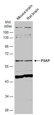 Various tissue extracts (50 μg) were separated by 10% SDS-PAGE, and the membrane was blotted with PSAP antibody [N1N3] (GTX101064) diluted at 1:1000. The HRP-conjugated anti-rabbit IgG antibody (GTX213110-01) was used to detect the primary antibody.