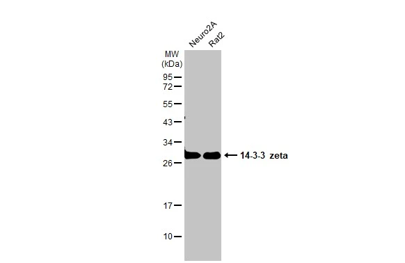 Various whole cell extracts (30 μg) were separated by 12% SDS-PAGE, and the membrane was blotted with 14-3-3 zeta antibody (GTX101075) diluted at 1:1000. The HRP-conjugated anti-rabbit IgG antibody (GTX213110-01) was used to detect the primary antibody.