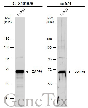 Whole cell extract (30 μg) was separated by 7.5% SDS-PAGE, and the membranes were blotted with ZAP70 antibody (GTX101076) diluted at 1:1000 and competitor's antibody (sc-574) diluted at 1:100. The HRP-conjugated anti-rabbit IgG antibody (GTX213110-01) was used to detect the primary antibody.