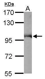 Sample (50 μg of whole cell lysate) A: Mouse brain 7.5% SDS PAGE GTX101089 diluted at 1:10000 The HRP-conjugated anti-rabbit IgG antibody (GTX213110-01) was used to detect the primary antibody.
