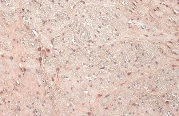 UBE3A antibody detects UBE3A protein at cytoplasm and nucleus by immunohistochemical analysis. Sample: Paraffin-embedded mouse brain. UBE3A stained by UBE3A antibody (GTX101092) diluted at 1:500. Antigen Retrieval: Citrate buffer, pH 6.0, 15 min
