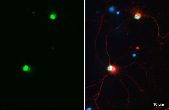 UBE3A antibody detects UBE3A protein at nucleus by immunofluorescent analysis. Sample: DIV10 rat E18 primary cortical neuron cells were fixed in 4% paraformaldehyde at RT for 15 min. Green: UBE3A stained by UBE3A antibody (GTX101092) diluted at 1:500. Red: Tau, an axon marker, stained by Tau antibody [GT287] (GTX634809) diluted at 1:500. Blue: Fluoroshield with DAPI (GTX30920).