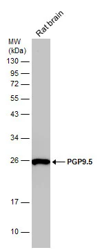 Rat tissue extract (50 μg) was separated by 12% SDS-PAGE, and the membrane was blotted with PGP9.5 antibody (GTX101093) diluted at 1:1000.