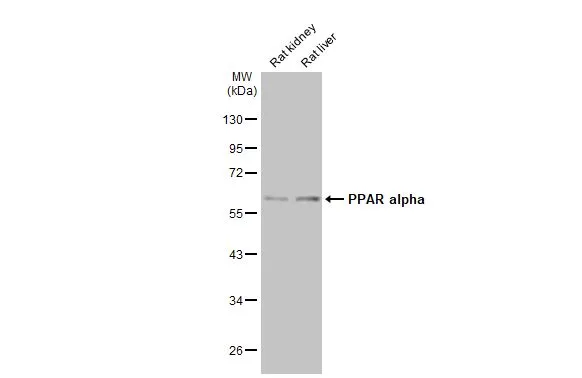 Various tissue extracts (50 μg) were separated by 10% SDS-PAGE, and the membrane was blotted with PPAR alpha antibody (GTX101098) diluted at 1:2000. The HRP-conjugated anti-rabbit IgG antibody (GTX213110-01) was used to detect the primary antibody.