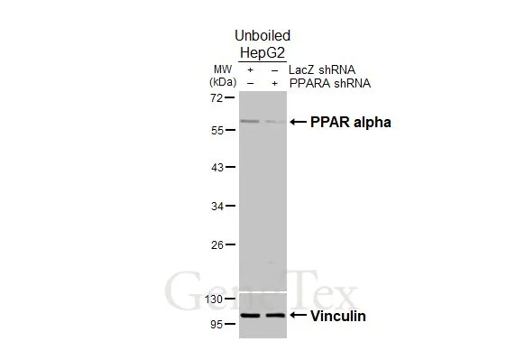 Non-transfected (–) and transfected (+) unboiled HepG2 whole cell extracts (30 μg) were separated by 10% SDS-PAGE, and the membrane was blotted with PPAR alpha antibody (GTX101098) diluted at 1:1000. The HRP-conjugated anti-rabbit IgG antibody (GTX213110-01) was used to detect the primary antibody.