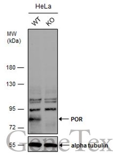 Wild-type (WT) and POR knockout (KO) HeLa cell extracts (30 μg) were separated by 7.5% SDS-PAGE, and the membrane was blotted with POR antibody [C2C3], C-term (GTX101101) diluted at 1:500. The HRP-conjugated anti-rabbit IgG antibody (GTX213110-01) was used to detect the primary antibody, and the signal was developed with Trident ECL plus-Enhanced.