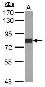 Sample (50 ug of whole cell lysate) A: mouse liver 7.5% SDS PAGE GTX101101 diluted at 1:1000 Sample (50 ug of whole cell lysate) A: mouse liver 7.5% SDS PAGE GTX101101 diluted at 1:1000