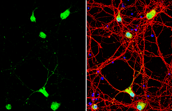 Neuregulin-1 antibody [C1C3] detects Neuregulin-1 protein by immunofluorescent analysis. Sample: DIV10 rat E18 primary cortical neuron cells were fixed in 4% paraformaldehyde at RT for 15 min. Green: Neuregulin-1 stained by Neuregulin-1 antibody [C1C3] (GTX101116) diluted at 1:500. Red: Tau, stained by Tau antibody [GT287] (GTX634809) diluted at 1:500. Blue: Fluoroshield with DAPI (GTX30920).