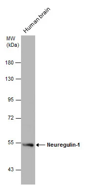 Human tissue extract (30 μg) was separated by 7.5% SDS-PAGE, and the membrane was blotted with Neuregulin-1 antibody (GTX101117) diluted at 1:1000. The HRP-conjugated anti-rabbit IgG antibody (GTX213110-01) was used to detect the primary antibody.