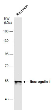 Rat tissue extract (50 μg) was separated by 7.5% SDS-PAGE, and the membrane was blotted with Neuregulin-1 antibody (GTX101117) diluted at 1:1000. The HRP-conjugated anti-rabbit IgG antibody (GTX213110-01) was used to detect the primary antibody.