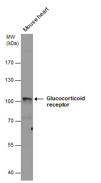 Glucocorticoid receptor antibody detects Glucocorticoid receptor protein by western blot analysis. Mouse tissue extracts (50 μg) was separated by 7.5% SDS-PAGE, and the membrane was blotted with Glucocorticoid receptor antibody (GTX101120) diluted at 1:1000.