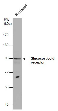 Glucocorticoid receptor antibody detects Glucocorticoid receptor protein by western blot analysis. Rat tissue extracts (50 μg) was separated by 7.5% SDS-PAGE, and the membrane was blotted with Glucocorticoid receptor antibody (GTX101120) diluted at 1:1000.