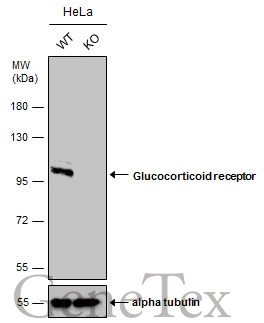 Wild-type (WT) and Glucocorticoid receptor knockout (KO) HeLa cell extracts (30 μg) were separated by 7.5% SDS-PAGE, and the membrane was blotted with Glucocorticoid receptor antibody (GTX101120) diluted at 1:500. The HRP-conjugated anti-rabbit IgG antibody (GTX213110-01) was used to detect the primary antibody.