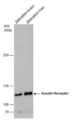 Insulin Receptor beta antibody detects Insulin Receptor beta protein by Western blot analysis. Zebrafish tissue extracts (30 μg) was separated by 5 % SDS-PAGE, and the membrane was blotted with Insulin Receptor beta antibody (GTX101136) at a dilution of 1:1000. Insulin Receptor beta antibody detects Insulin Receptor beta protein by Western blot analysis. Zebrafish tissue extracts (30 μg) was separated by 5 % SDS-PAGE, and the membrane was blotted with Insulin Receptor beta antibody (GTX101136) at a dilution of 1:1000.