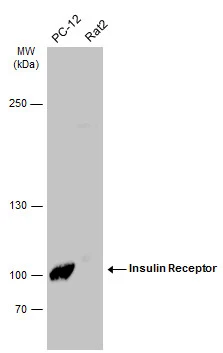 Various whole cell extracts (50 μg) were separated by 5% SDS-PAGE, and the membrane was blotted with Insulin Receptor beta antibody (GTX101136) diluted at 1:1000. The HRP-conjugated anti-rabbit IgG antibody (GTX213110-01) was used to detect the primary antibody. Various whole cell extracts (50 μg) were separated by 5% SDS-PAGE, and the membrane was blotted with Insulin Receptor beta antibody (GTX101136) diluted at 1:1000. The HRP-conjugated anti-rabbit IgG antibody (GTX213110-01) was used to detect the primary antibody.