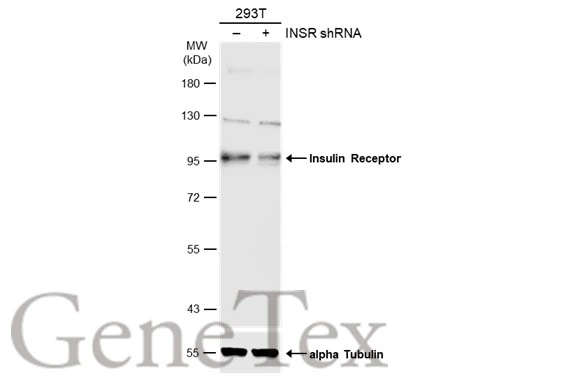 Non-transfected (–) and transfected (+) 293T whole cell extracts (30 μg) were separated by 7.5% SDS-PAGE, and the membrane was blotted with Insulin Receptor beta antibody (GTX101136) diluted at 1:1000. The HRP-conjugated anti-rabbit IgG antibody (GTX213110-01) was used to detect the primary antibody. Non-transfected (–) and transfected (+) 293T whole cell extracts (30 μg) were separated by 7.5% SDS-PAGE, and the membrane was blotted with Insulin Receptor beta antibody (GTX101136) diluted at 1:1000. The HRP-conjugated anti-rabbit IgG antibody (GTX213110-01) was used to detect the primary antibody.