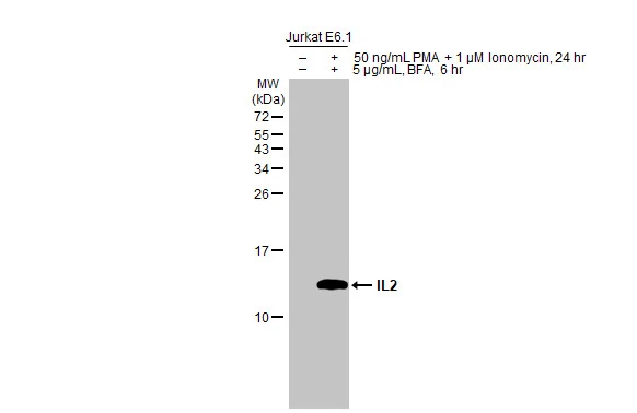 Untreated (–) and treated (+) Jurkat E6.1 whole cell extracts (30 μg) were separated by 15% SDS-PAGE, and the membrane was blotted with IL2 antibody (GTX101138) diluted at 1:500. The HRP-conjugated anti-rabbit IgG antibody (GTX213110-01) was used to detect the primary antibody.