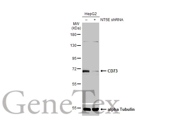 Non-transfected (–) and transfected (+) HepG2 whole cell extracts (30 μg) were separated by 7.5% SDS-PAGE, and the membrane was blotted with CD73 antibody [N3C3] (GTX101140) diluted at 1:1000. The HRP-conjugated anti-rabbit IgG antibody (GTX213110-01) was used to detect the primary antibody.