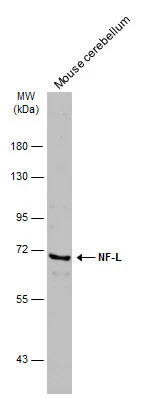 Mouse tissue extract (5 μg) was separated by 7.5% SDS-PAGE, and the membrane was blotted with NF-L antibody (GTX101142) diluted at 1:500. The HRP-conjugated anti-rabbit IgG antibody (GTX213110-01) was used to detect the primary antibody.