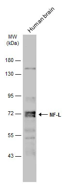 Human brain (30 μg) was separated by 7.5% SDS-PAGE, and the membrane was blotted with NF-L antibody (GTX101142) diluted at 1:1000. The HRP-conjugated anti-rabbit IgG antibody (GTX213110-01) was used to detect the primary antibody.
