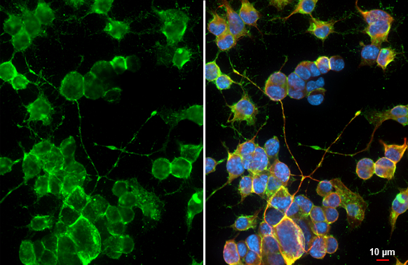 NF-L antibody detects NF-L protein by immunofluorescent analysis. Sample: Neuro2A cells were fixed in 4% paraformaldehyde at RT for 15 min. Green: NF-L stained by NF-L antibody (GTX101142) diluted at 1:500. Red: alpha Tubulin, a cytoskeleton marker, stained by alpha Tubulin antibody [GT114] (GTX628802) diluted at 1:1000. Blue: Fluoroshield with DAPI (GTX30920).
