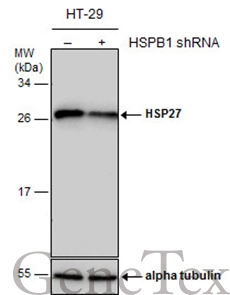 Non-transfected (–) and transfected (+) HT-29 whole cell extracts (30 μg) were separated by 12% SDS-PAGE, and the membrane was blotted with HSP27 antibody (GTX101145) diluted at 1:10000. The HRP-conjugated anti-rabbit IgG antibody (GTX213110-01) was used to detect the primary antibody.