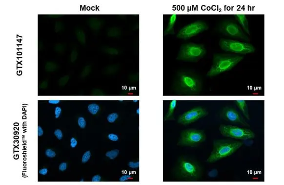 Heme Oxygenase 1 antibody detects Heme Oxygenase 1 protein at endoplasmic reticulum and nucleus by immunofluorescent analysis. Sample: Mock and treated HeLa cells were fixed in 4% paraformaldehyde at RT for 15 min. Green: Heme Oxygenase 1 stained by Heme Oxygenase 1 antibody (GTX101147) diluted at 1:500. Blue: Fluoroshield with DAPI (GTX30920).