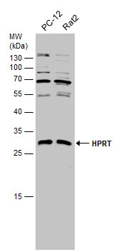 Various whole cell extracts (30 μg) were separated by 12% SDS-PAGE, and the membrane was blotted with HPRT antibody (GTX101148) diluted at 1:1000.