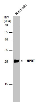 Rat tissue extract (50 μg) was separated by 12% SDS-PAGE, and the membrane was blotted with HPRT antibody (GTX101148) diluted at 1:500.