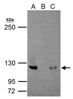 Wild-type (WT) and NFkB p100 knockout (KO) HeLa cell extracts (30 ug) were separated by 7.5% SDS-PAGE,and the membrane was blotted with NFkB p100 antibody [C2C3],C-term (GTX101150) diluted at 1:500.