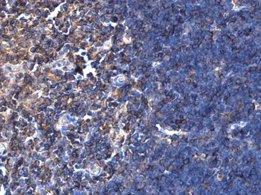 NFkB p100/p52 antibody [N1N3] detects NFKB2 protein at cytoplasm in rat thymus by immunohistochemical analysis. Sample: Paraffin-embedded rat lymph node. NFkB p100/p52 antibody [N1N3] (GTX101151) diluted at 1:500. 
 Antigen Retrieval: Citrate buffer, pH 6.0, 15 min