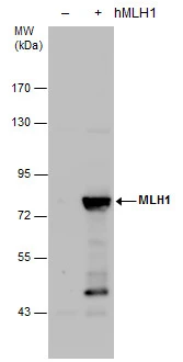 MLH1 antibody detects MLH1 protein by western blot analysis. Non-transfected (-) and MLH1-transfected (+, ) 293T whole cell extracts (30 μg) were separated by 7.5% SDS-PAGE, and the membrane was blotted with MLH1 antibody (GTX101160) at a dilution of 1:20000.