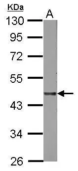 Sample (50 μg of whole cell lysate) A: mouse Liver 10% SDS PAGE GTX101169 diluted at 1:1000 The HRP-conjugated anti-rabbit IgG antibody (GTX213110-01) was used to detect the primary antibody. Sample (50 μg of whole cell lysate) A: mouse Liver 10% SDS PAGE GTX101169 diluted at 1:1000 The HRP-conjugated anti-rabbit IgG antibody (GTX213110-01) was used to detect the primary antibody.