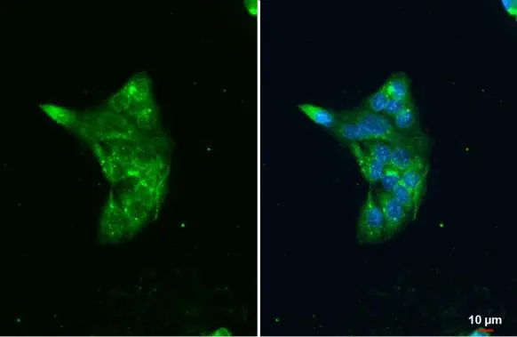 LAL antibody [N3C3] detects LAL protein at lysosome by immunofluorescent analysis. Sample: HepG2 cells were fixed in ice-cold MeOH for 5 min. Green: LAL stained by LAL antibody [N3C3] (GTX101169) diluted at 1:500. Blue: Fluoroshield with DAPI (GTX30920).