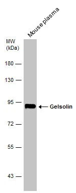 Mouse tissue extract (50 μg) was separated by 7.5% SDS-PAGE, and the membrane was blotted with Gelsolin antibody [C2C3], C-term (GTX101185) diluted at 1:500.