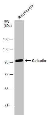 Rat tissue extract (50 μg) was separated by 7.5% SDS-PAGE, and the membrane was blotted with Gelsolin antibody [C2C3], C-term (GTX101185) diluted at 1:500.