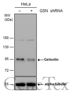Non-transfected (–) and transfected (+) HeLa whole cell extracts (30 μg) were separated by 7.5% SDS-PAGE, and the membrane was blotted with Gelsolin antibody [C2C3], C-term (GTX101185) diluted at 1:500.