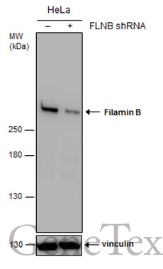 Non-transfected (–) and transfected (+) HeLa whole cell extracts (30 μg) were separated by 5% SDS-PAGE, and the membrane was blotted with Filamin B antibody [N1], N-term (GTX101206) diluted at 1:6000. The HRP-conjugated anti-rabbit IgG antibody (GTX213110-01) was used to detect the primary antibody.