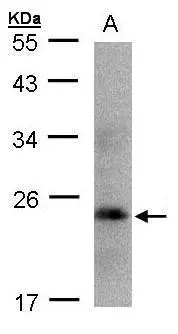 Growth Hormone antibody [N1C3]