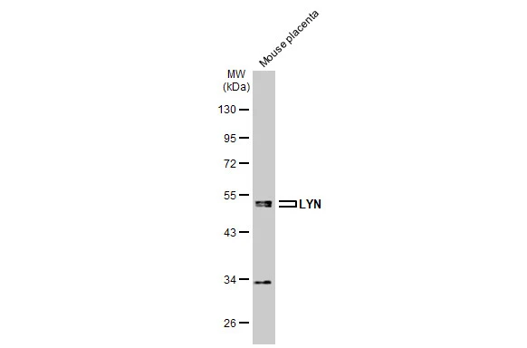 Mouse tissue extract (50 μg) was separated by 10% SDS-PAGE, and the membrane was blotted with LYN antibody (GTX101222) diluted at 1:500. The HRP-conjugated anti-rabbit IgG antibody (GTX213110-01) was used to detect the primary antibody.