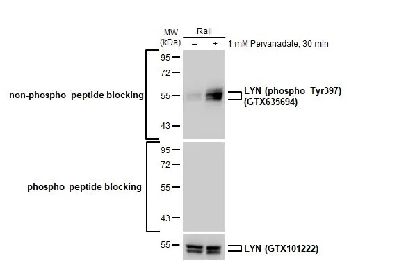 Untreated (–) and treated (+) Raji whole cell extracts (30 μg) were separated by 10% SDS-PAGE, and the membrane was blotted with LYN antibody (GTX101222) diluted at 1:1000. The HRP-conjugated anti-rabbit IgG antibody (GTX213110-01) was used to detect the primary antibody, and the signal was developed with Trident ECL plus-Enhanced.