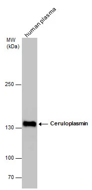 Ceruloplasmin antibody detects Ceruloplasmin protein by western blot analysis. Human tissue extracts (30 μg) was separated by 5% SDS-PAGE, and the membrane was blotted with Ceruloplasmin antibody (GTX101231) diluted at 1:500.
