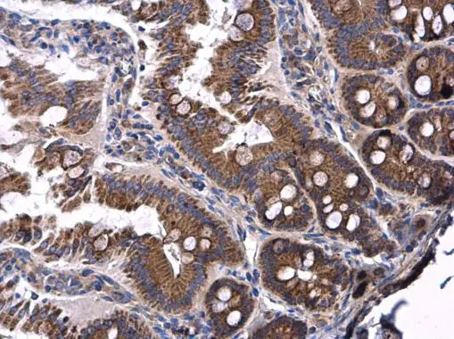 Ceruloplasmin antibody detects Ceruloplasmin protein at cytoplasm in rat duodenum by immunohistochemical analysis. Sample: Paraffin-embedded rat duodenum. Ceruloplasmin antibody (GTX101231) diluted at 1:500.
Antigen Retrieval: Citrate buffer, pH 6.0, 15 min Ceruloplasmin antibody detects Ceruloplasmin protein at cytoplasm in rat duodenum by immunohistochemical analysis. Sample: Paraffin-embedded rat duodenum. Ceruloplasmin antibody (GTX101231) diluted at 1:500.
Antigen Retrieval: Citrate buffer, pH 6.0, 15 min